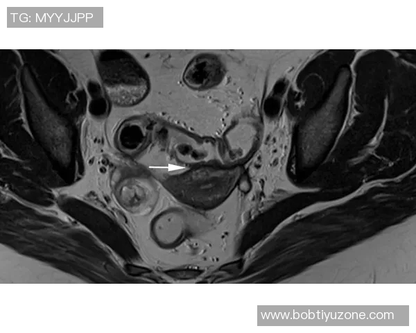 约维奇重摔受伤退场X光检查结果无异常明日将进行MRI检查评估伤情